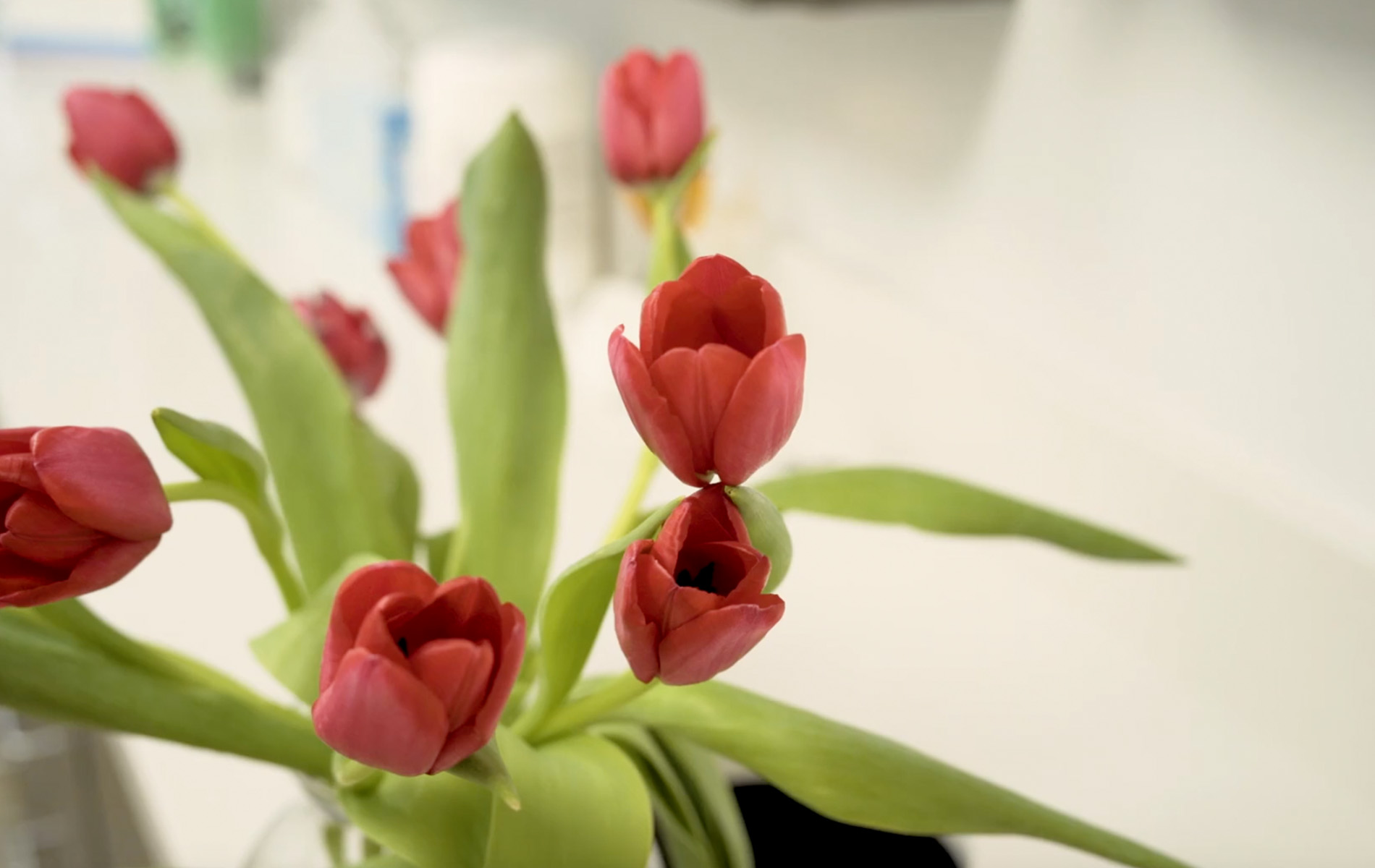 Vernon Woods Dental   Implant Center | Veneers, Fluoride Treatment and Dental Sealants