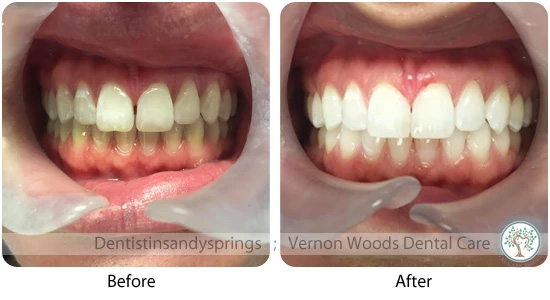 Vernon Woods Dental Implant Center | Pediatric Dentistry, Sports Mouthguards and Botox reg