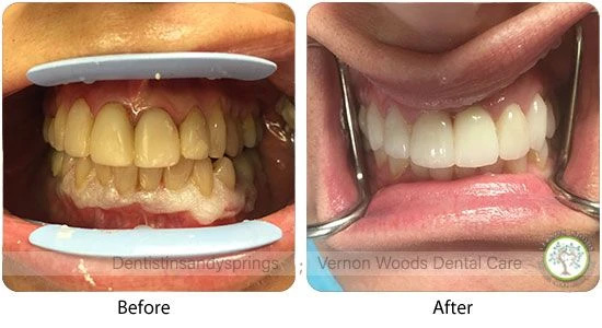 Vernon Woods Dental Implant Center | Invisalign reg , Dentures and Dental Bridges