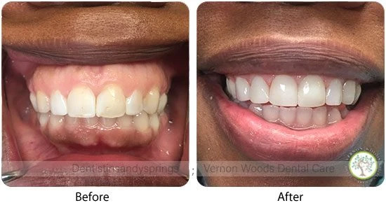 Vernon Woods Dental & Implant Center | Emergency Treatment, Periodontal Treatment and Implant Dentistry