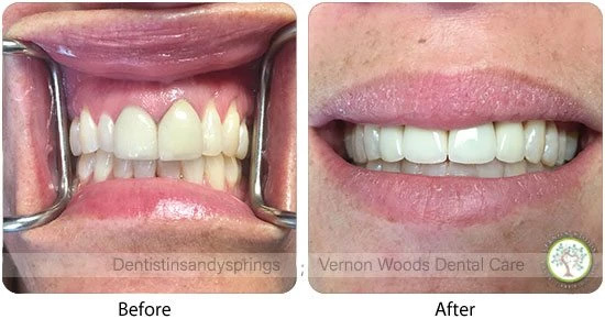 Vernon Woods Dental & Implant Center | Pediatric Dentistry, Implant Dentistry and Piezo Ultrasonic Scaler