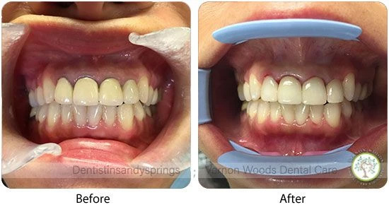 Vernon Woods Dental & Implant Center | Digital Radiography, Dental Cleanings and Full Mouth Reconstruction