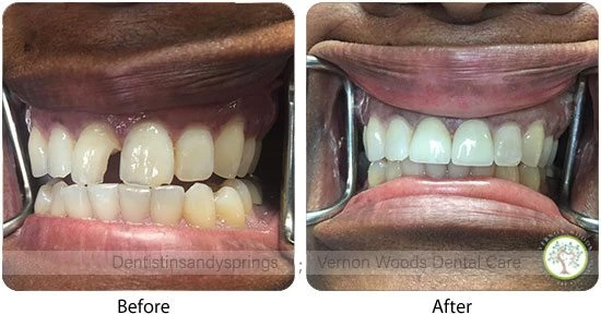 Vernon Woods Dental & Implant Center | Dentures, Oral Cancer Screening and Oral Exams