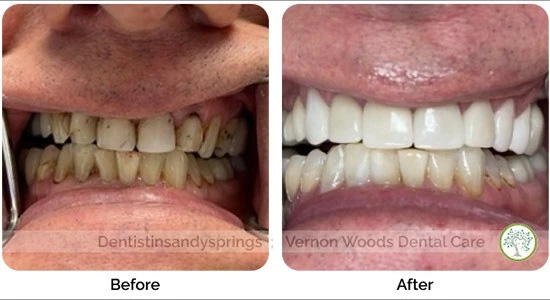 Vernon Woods Dental & Implant Center | Teeth Whitening, Cosmetic Dentistry and Implant Dentistry
