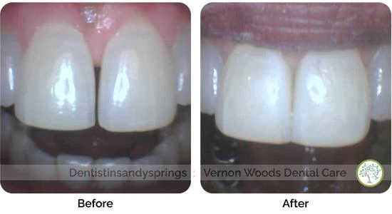 Vernon Woods Dental & Implant Center | Root Canals, Oral Exams and Botox&reg;