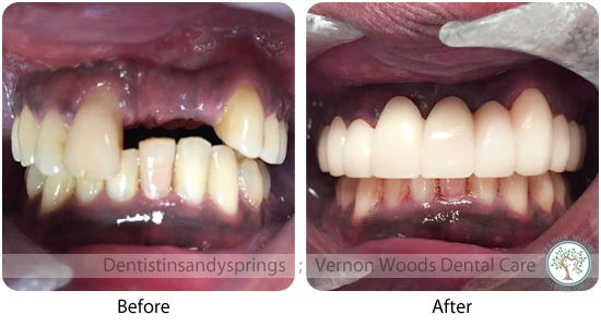 Vernon Woods Dental Implant Center | Oral Exams, Periodontal Treatment and All-on-4 reg