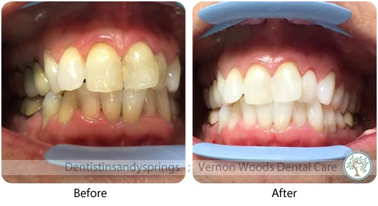 Vernon Woods Dental Implant Center | Dental Bridges, Emergency Treatment and Teeth-In-A-Day