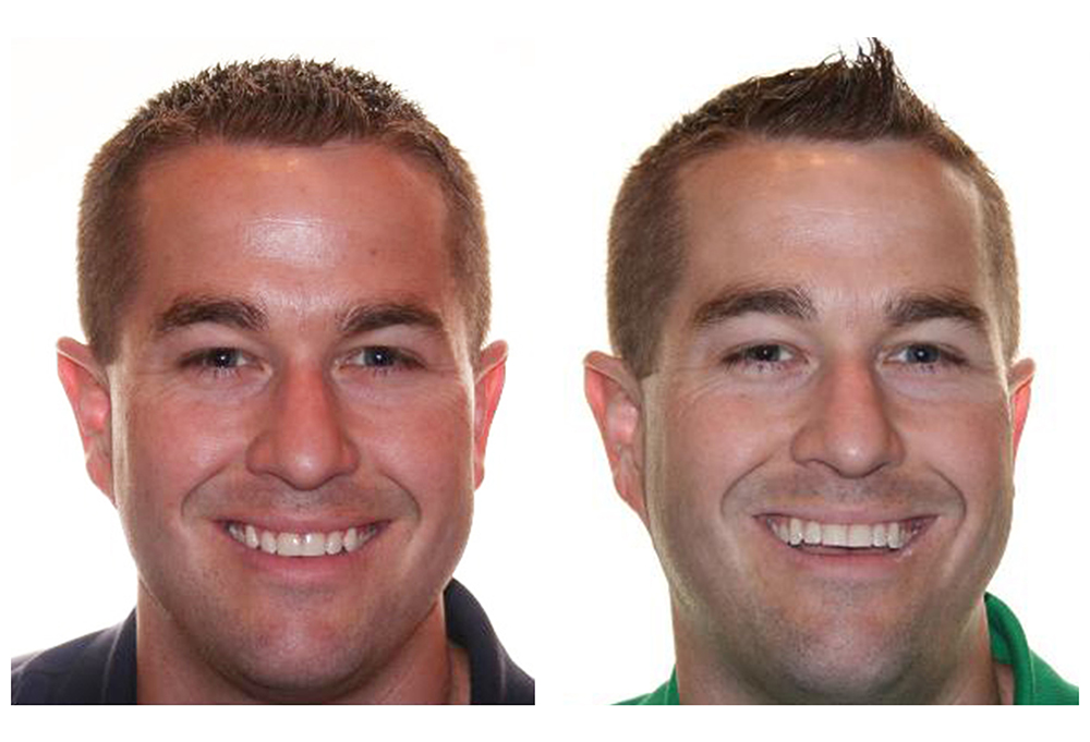 Vernon Woods Dental Implant Center