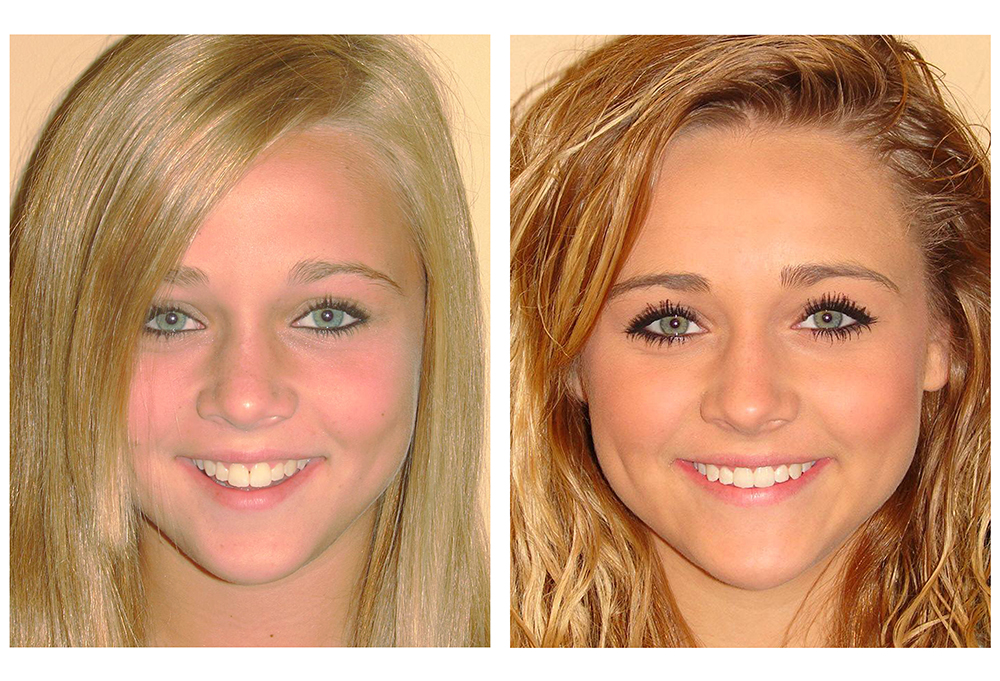 Vernon Woods Dental Implant Center