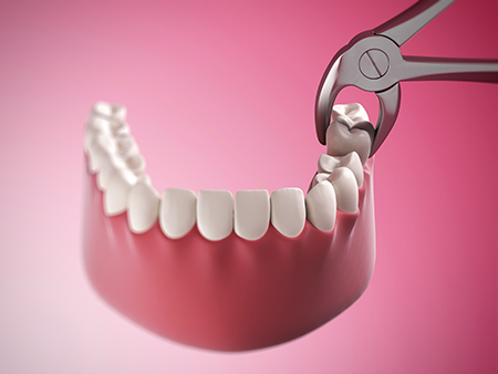 Vernon Woods Dental Implant Center | All-on-4 reg , Implant Dentistry and Digital Radiography